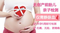 无创产前胎儿亲子鉴定准确吗？做后需要复查吗？