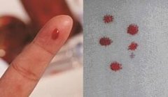 干枯血液样本能否用于亲子鉴定？解答及保存建议