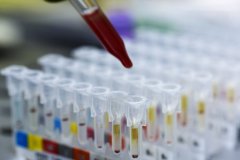 DNA同一认定的准确性有多高？科学与技术的双重保障