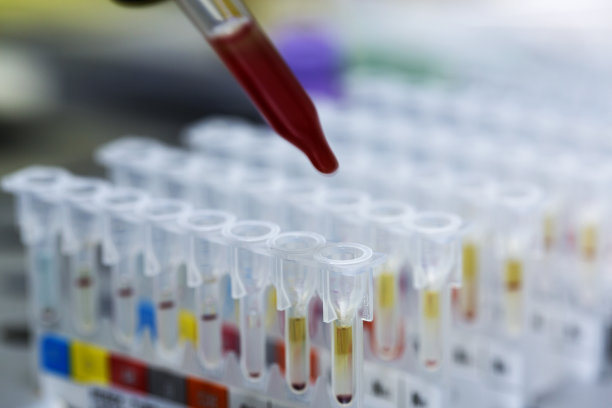 DNA同一认定的准确性有多高？科学与技术的双重保障