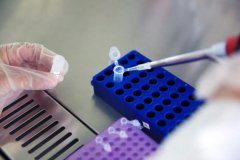 微量样本亲子鉴定技术：如何在极少DNA下实现高精度