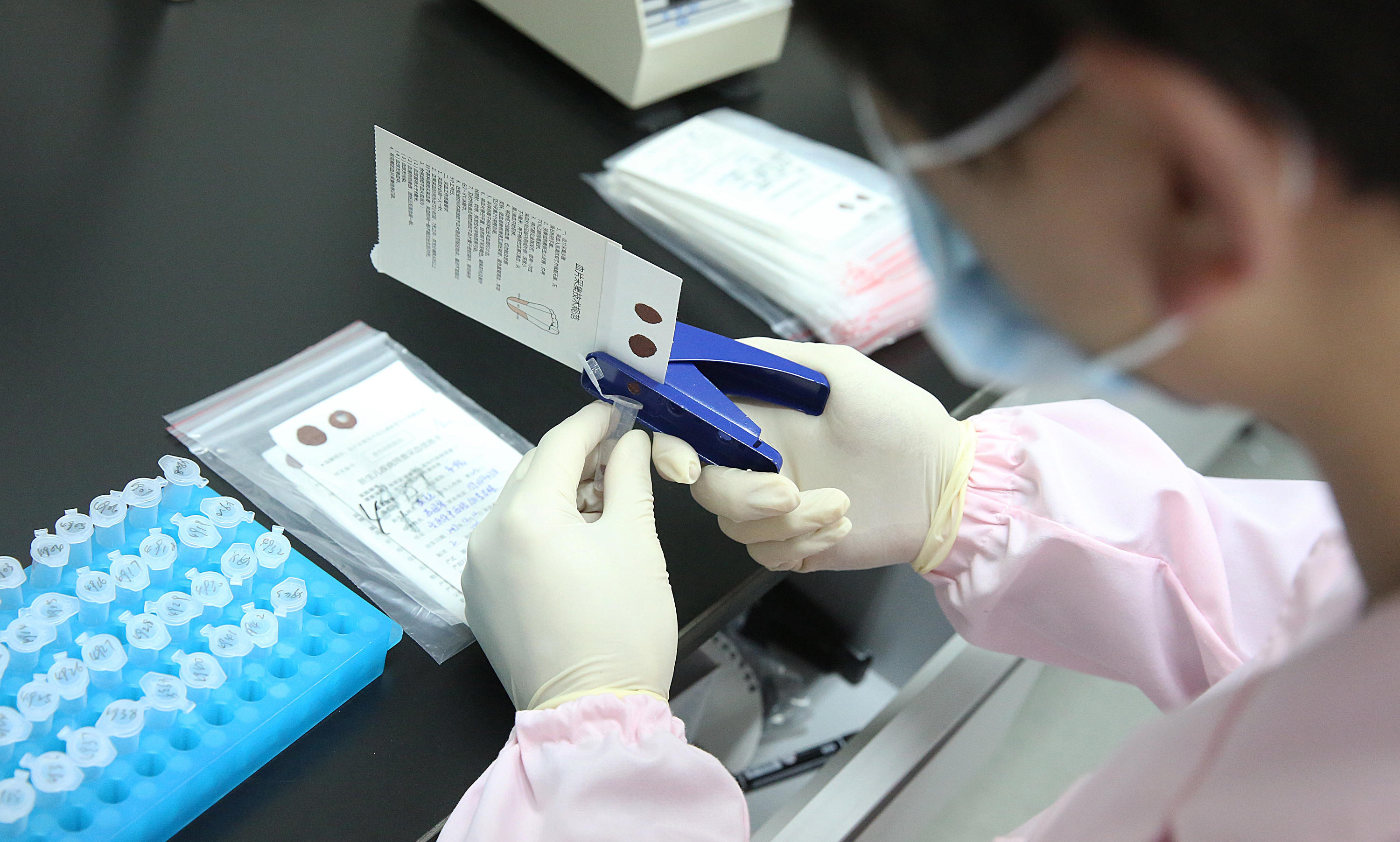 亲子鉴定中的实验室质量控制：如何避免误差和污染？