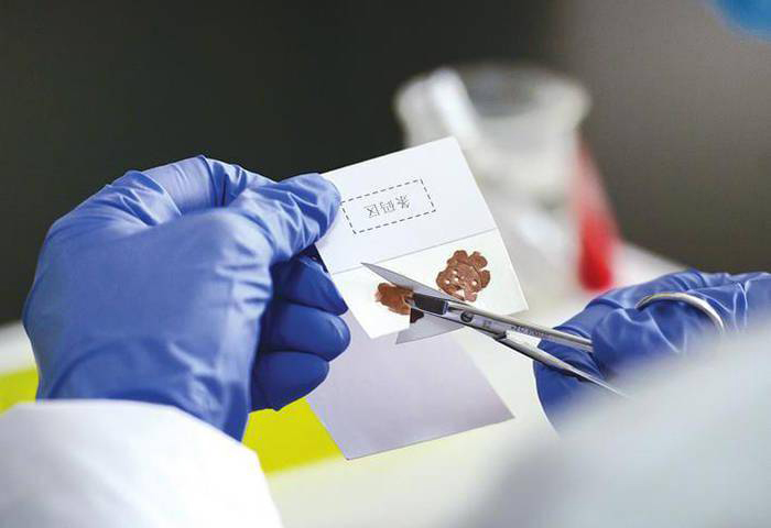亲子鉴定样本怎么选？血液、口腔拭子、毛发...哪种更准确？