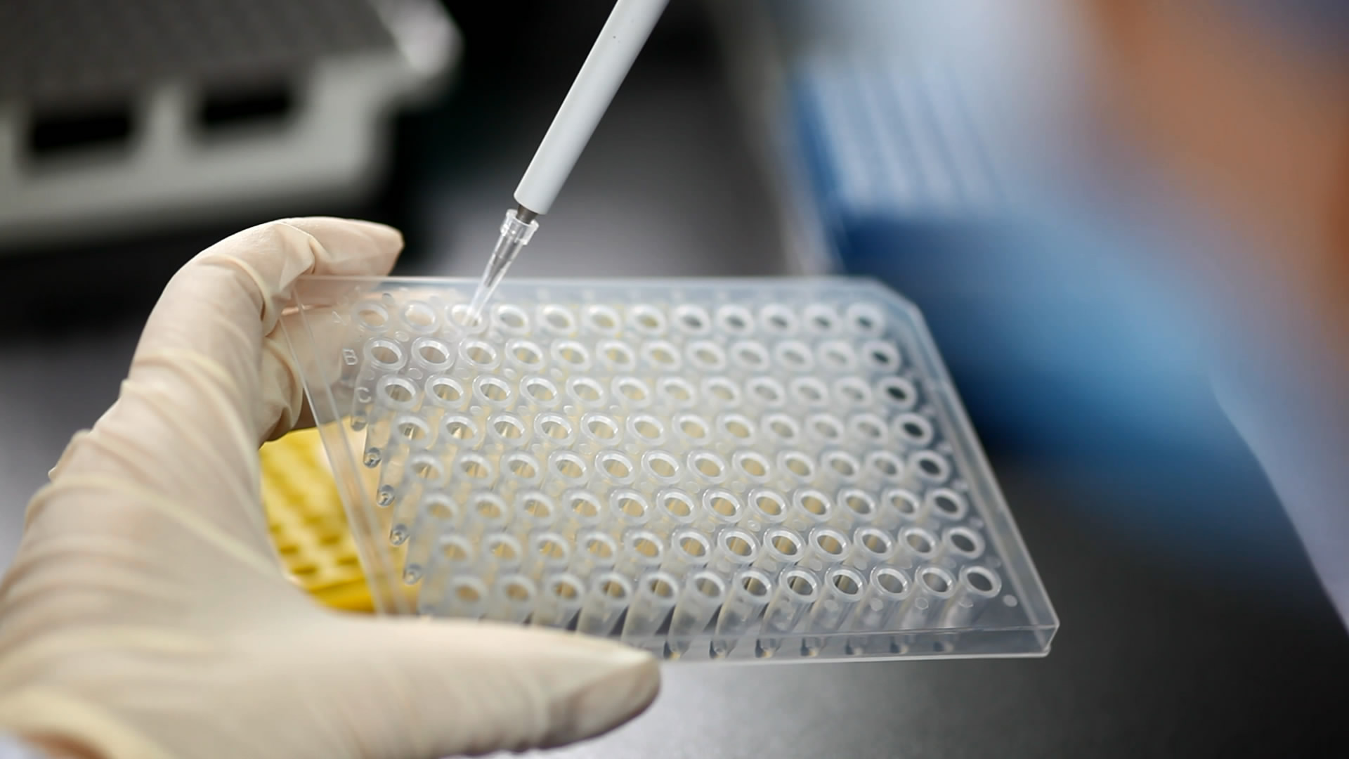 亲子鉴定的结果有几种？科学解读背后的生物学密码