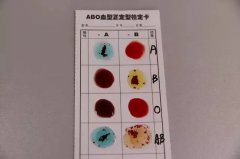 血型对不上就非亲生？DNA鉴定：别被“常识”骗了！